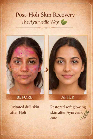 Post-Holi Skin Recovery the Ayurvedic Way with Ayuveda Glow