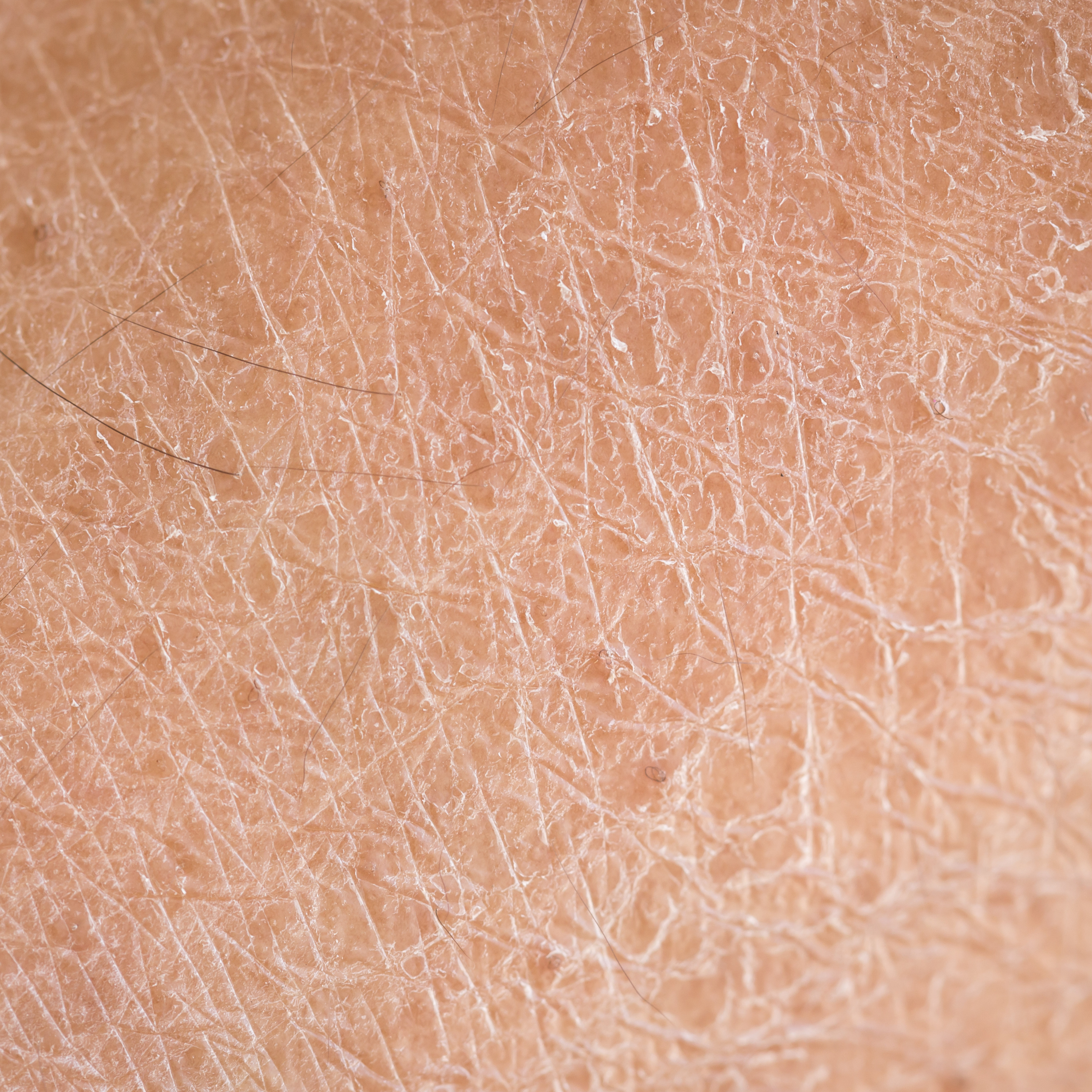 Dry & Dull Skin